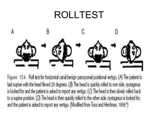 ROLLTEST
 