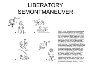 LIBERATORY
SEMONTMANEUVER
 