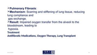 05/13/2025 32
Pulmonary Fibrosis:
Mechanism: Scarring and stiffening of lung tissue, reducing
lung compliance and
gas exchange.
Result: Impaired oxygen transfer from the alveoli to the
bloodstream, leading to
hypoxia.
Treatment
Antifibrotic Medications, Oxygen Therapy, Lung Transplant
 