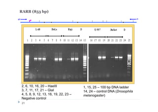 d1 r1
2, 6, 10, 16, 20 – HaeIII
3, 7, 11, 17, 21 – GlaI
4, 5, 8, 9, 12, 13, 18, 19, 22, 23 –
Negative control
1, 15, 25 – 100 bp DNA ladder
14, 24 – control DNA (Drosophila
melanogaster)
RARB (853 bp)
21
 
