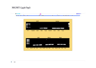 MGMT (356 bp)
U937 Jurkat
M HaeIII GlaI BlsI TaqI HaeIII GlaI BlsI TaqI
L68 HeLa Raji
M HaeIII GlaI BlsI TaqI HaeIII GlaI BlsI TaqI HaeIII GlaI BlsI TaqI
r1d2
22
 