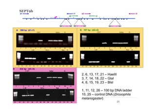 SEPT9b
A 399 bp (d1-r1)
U937 Jurkat D
1 2 3 4 5 6 7 8 9 10 11
L68 HeLa Raji D
12 13 14 15 16 17 18 19 20 21 22 23 24 25 26
Б 197 bp (d2-r2)
U937 Jurkat D
1 2 3 4 5 6 7 8 9 10 11
L68 HeLa Raji D
12 13 14 15 16 17 18 19 20 21 22 23 24 25 26
GCGCAGCGC GCGCCGCGC GCGCCGCGC
d1
d2
d3r1
r2
r3
2, 6, 13, 17, 21 – HaeIII
3, 7, 14, 18, 22 – GlaI
4, 8, 15, 19, 23 – BlsI
1, 11, 12, 26 – 100 bp DNA ladder
10, 25 – control DNA (Drosophila
melanogaster)
23
 
