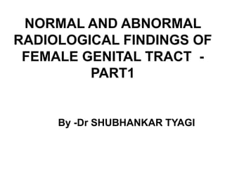 NORMAL AND ABNORMAL
RADIOLOGICAL FINDINGS OF
FEMALE GENITAL TRACT -
PART1
By -Dr SHUBHANKAR TYAGI
 