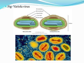  Fig- Variola virus
 
