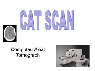 C omputed  A xial  T omograph CAT SCAN 