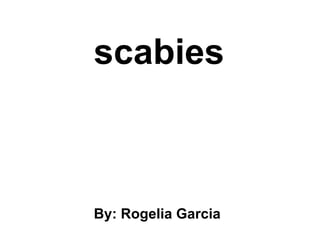 scabies By: Rogelia Garcia   