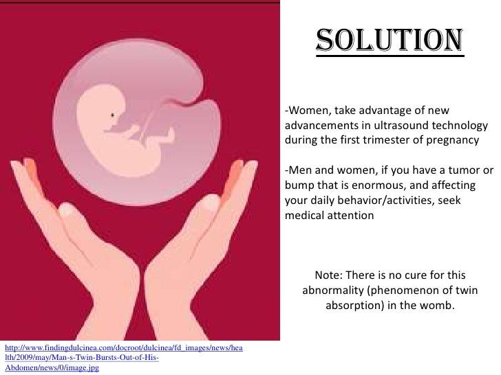 bio wiki Twin Absorption