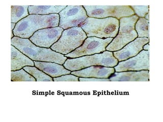Simple Squamous Epithelium   