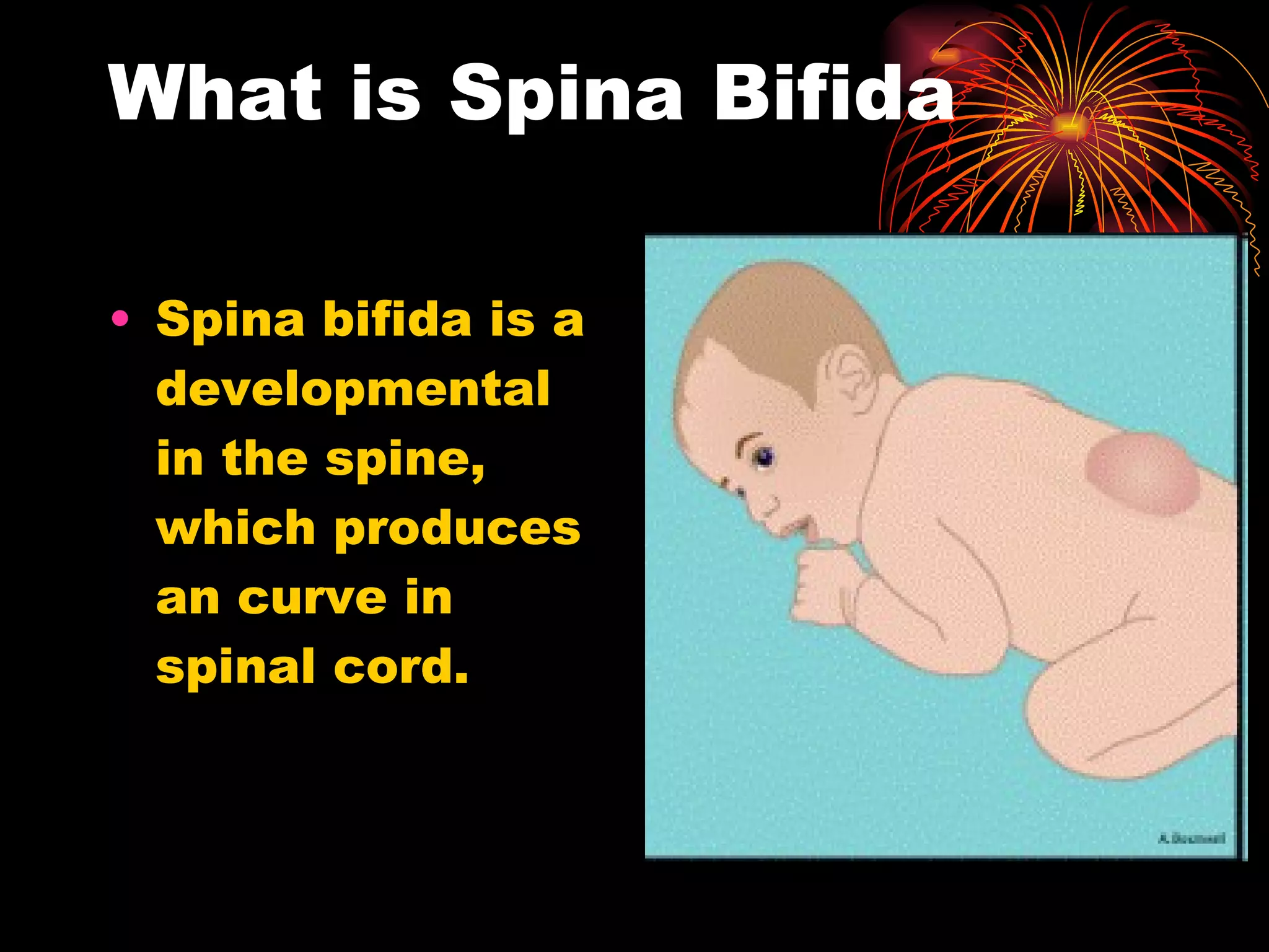 What is Spina Bifida Spina bifida is a developmental in the spine, which produces an curve in spinal cord.
