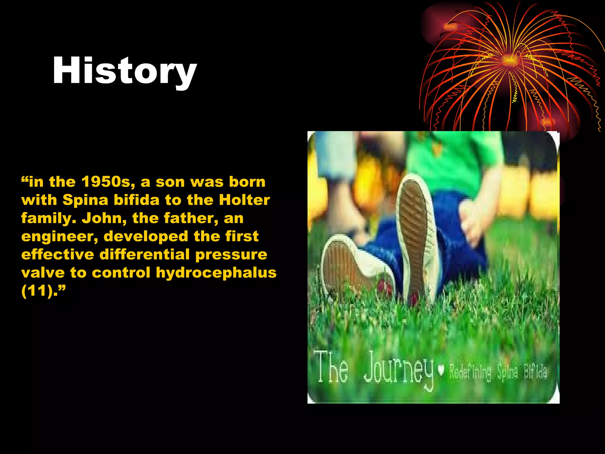History “ in the 1950s, a son was born with Spina bifida to the Holter family. John, the father, an engineer, developed the first effective differential pressure valve to control hydrocephalus (11).”