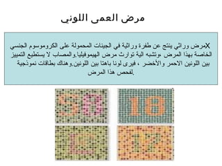 مرض وراثي ينتج عن طفرة وراثية في الجينات المحمولة على الكروموسوم الجنسي  X  الخاصة بهذا المرض ،وتشبه الية توارث مرض اليموفيليا . والمصاب لا يستطيع التمييز بين اللونين الاحمر والأخضر ، فيرى لونا باهتا بين اللونين . وهناك بطاقات نموذجية  لفحص هذا المرض . مرض العمى اللوني 
