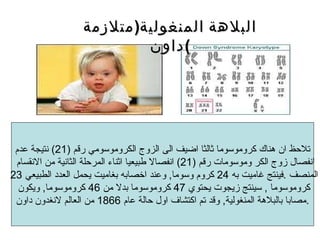 تلاحظ ان هناك كروموسوما ثالثا اضيف الى الزوج الكروموسومي رقم  (21)  نتيجة عدم انفصال زوج الكر وموسومات رقم  (21)  انفصالا طبيعيا اثناء المرحلة الثانية من الانقسام  المنصف  . فينتج غاميت به  24  كروم وسوما ,  وعند اخصابه بغاميت يحمل العدد الطبيعي  23  كروموسوما  ,  سينتج زيجوت يحتوي  47  كروموسوما بدلا من  46  كروموسوما ,  ويكون  مصابا بالبلاهة المنغولية ,  وقد تم اكتشاف اول حالة عام  1866  من العالم لانغدون داون . البلاهة المنغولية ( متلازمة داون ) 
