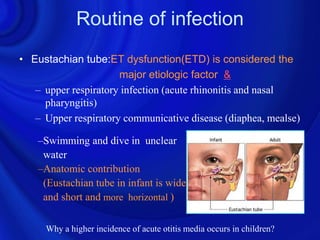 Routine of infection
• Eustachian tube:ET dysfunction(ETD) is considered the
                      major etiologic factor &
   – upper respiratory infection (acute rhinonitis and nasal
     pharyngitis)
   – Upper respiratory communicative disease (diaphea, mealse)

    –Swimming and dive in unclear
     water
    –Anatomic contribution
     (Eustachian tube in infant is wide
     and short and more horizontal )

     Why a higher incidence of acute otitis media occurs in children?
 