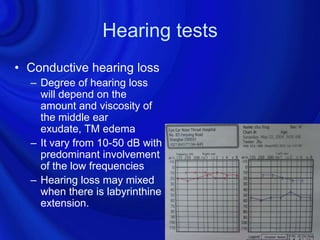 Hearing tests
• Conductive hearing loss
  – Degree of hearing loss
    will depend on the
    amount and viscosity of
    the middle ear
    exudate, TM edema
  – It vary from 10-50 dB with
    predominant involvement
    of the low frequencies
  – Hearing loss may mixed
    when there is labyrinthine
    extension.
 