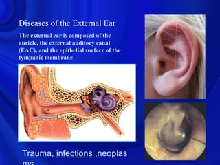 Diseases of the External Ear
The external ear is composed of the
auricle, the external auditory canal
(EAC), and the epithelial surface of the
tympanic membrane




 Trauma, infections ,neoplas
 