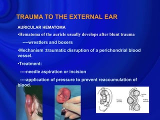 TRAUMA TO THE EXTERNAL EAR
AURICULAR HEMATOMA
•Hematoma of the auricle usually develops after blunt trauma
  ----wrestlers and boxers
•Mechanism :traumatic disruption of a perichondrial blood
vessel.
•Treatment:
 ----needle aspiration or incision
 ----application of pressure to prevent reaccumulation of
blood.
 