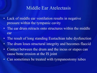Middle Ear Atelectasis

• Lack of middle ear ventilation results in negative
  pressure within the tympanic cavity
• The ear drum retracts onto structures within the middle
  ear
• The result of long standing Eustachian tube dysfunction
• The drum loses structural integrity and becomes flaccid
• Contact between the drum and the incus or stapes can
  cause bone erosion at the IS joint
• Can sometimes be treated with tympanostomy tubes
 