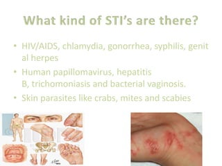 Can STI’s be cured?Many STI’s can be treated but only some can be cured.STI’s caused by bacteria, microorganisms or protozoa can be treated by antibodies, topical creams or lotionsCurable means that the infection organism can be killed by treatment and stop the spread of the infectionAlthough, damage already done to the body can not be undone