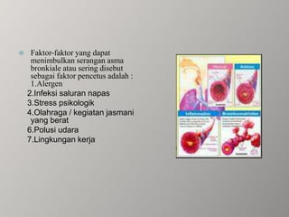 Faktor-faktor yang dapat menimbulkan serangan asma bronkiale atau sering disebut sebagai faktor pencetus adalah : 1.Alergen    2.Infeksi saluran napas    3.Stress psikologik    4.Olahraga / kegiatan jasmani yang berat    6.Polusi udara    7.Lingkungan kerja