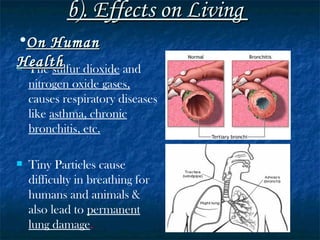 b). Effects on Living  The  sulfur dioxide  and  nitrogen oxide gases,  causes respiratory diseases like  asthma, chronic   bronchitis, etc. Tiny Particles cause difficulty in breathing for humans and animals & also lead to  permanent lung damage .   On Human Health 