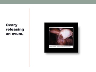 Ovary
releasing
an ovum.
 