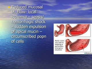 • Reduced mucosal
 bl. Flow- local
 ischemia – sepsis/
 hemorrhagic shock
 – sudden expulsion
 of apical mucin –
 circumscribed popn
 of cells
 