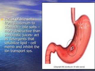 • Reflux of bile salts
  from duodenum to
  stomach – bile salts –
  more destructive than
  pancreatic juices- act
  as detergents that
  solubilize lipid - cell
  memb and inhibit the
  ion transport sys.
 