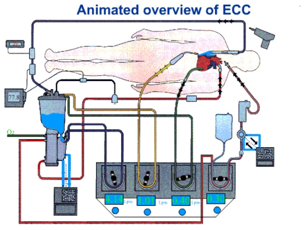 principles of cardiopulmonary bypass