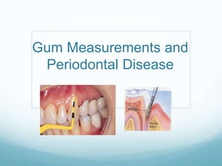 Gum Measurements and
 Periodontal Disease
 