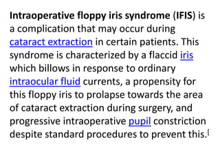 What Is Floppy Iris Syndrome?