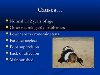 Causes…
   Normal till 2 years of age
   Other neurological disturbances
   Lower socio economic strata
   Parental neglect
   Poor supervision
   Lack of affection
   Malnourished
 