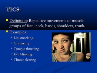 TICS:
   Definition: Repetitive movements of muscle
    groups of face, neck, hands, shoulders, trunk.
   Examples:
     Lip smacking
     Grimacing

     Tongue thrusting

     Eye blinking

     Throat clearing
 