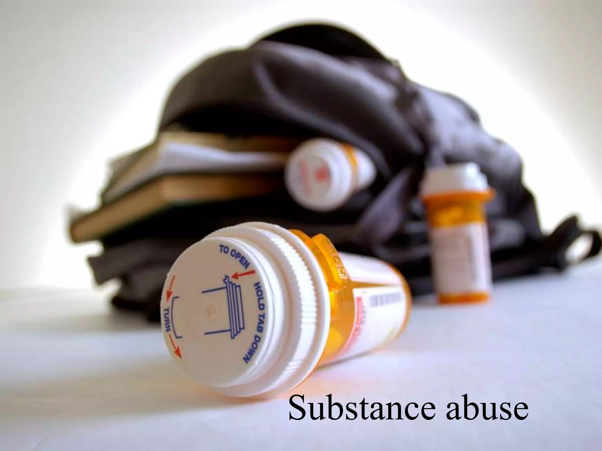 Substance abuse
 