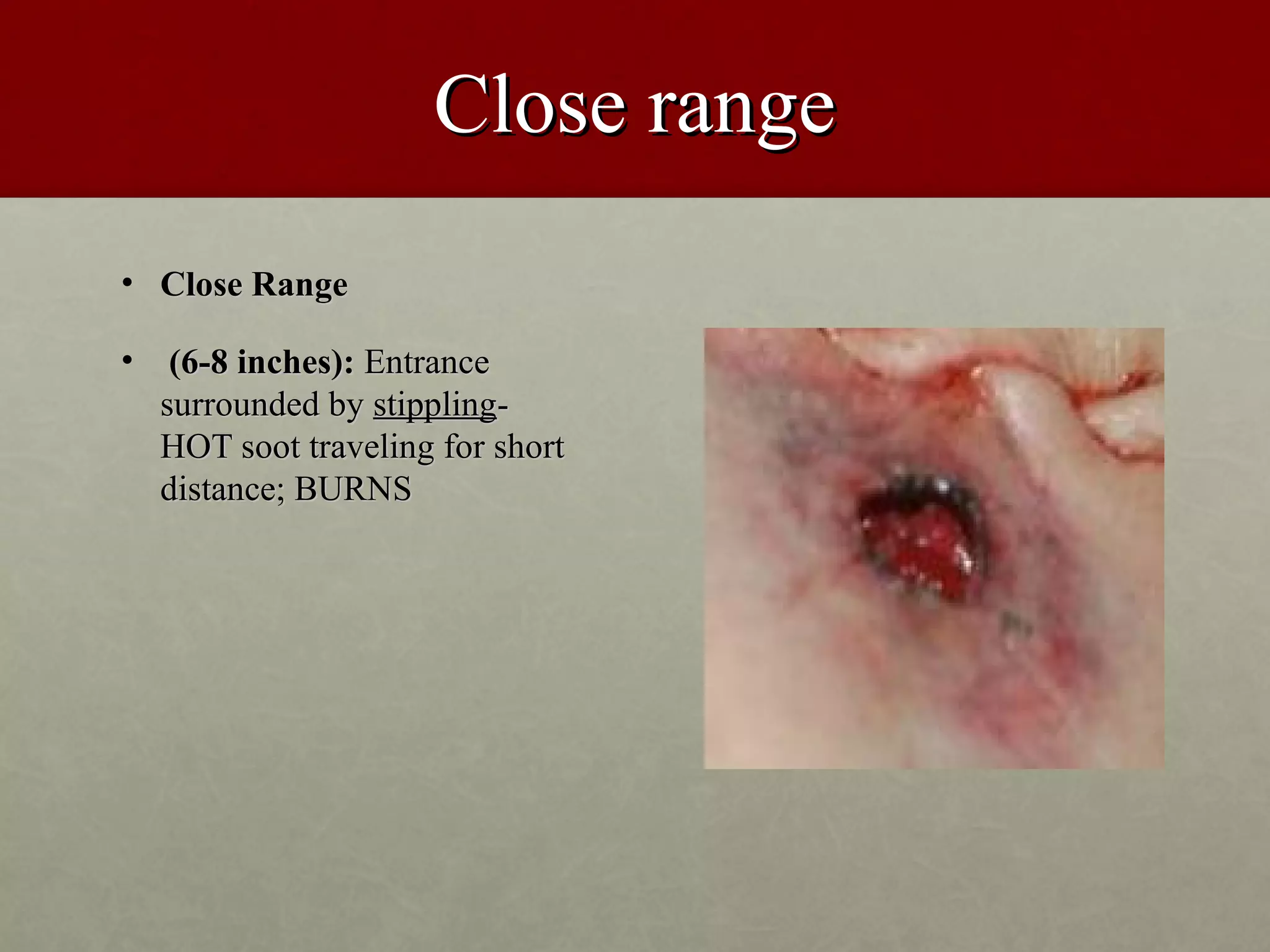 Close range
• Close Range

•    (6-8 inches): Entrance
    surrounded by stippling-
    HOT soot traveling for short
    distance; BURNS
 