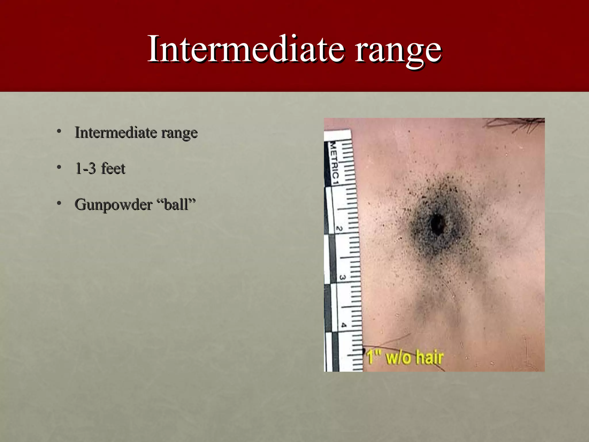 Intermediate range
• Intermediate range

• 1-3 feet

• Gunpowder “ball”
 