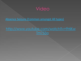Absence Seizure (Common amongst All types)


http://www.youtube.com/watch?v=9HiKw
                 Tm755o
 