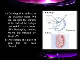 A) Drawing of an embryo at
the mudghah stage. We
can see here the somites
at the back of the embryo
that look like teeth marks.
(The Developing Human,
Moore and Persaud, 5th
ed., p. 79)
B) Photograph of a piece of
gum that has been
chewed.
 