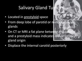Salivary Gland Tumors
• Located in prestyloid space
• From deep lobe of parotid or minor salivary
glands
• On CT or MRI a fat plane between the parotid
and a prestyloid mass indicates minor salivary
gland origin
• Displace the internal carotid posteriorly
 