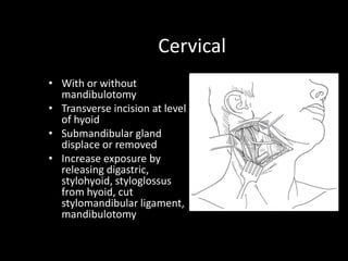 Cervical
• With or without
mandibulotomy
• Transverse incision at level
of hyoid
• Submandibular gland
displace or removed
• Increase exposure by
releasing digastric,
stylohyoid, styloglossus
from hyoid, cut
stylomandibular ligament,
mandibulotomy
 