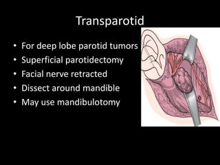 Transparotid
• For deep lobe parotid tumors
• Superficial parotidectomy
• Facial nerve retracted
• Dissect around mandible
• May use mandibulotomy
 