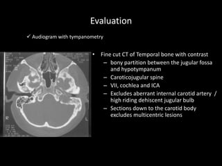 Evaluation
• Fine cut CT of Temporal bone with contrast
– bony partition between the jugular fossa
and hypotympanum
– Caroticojugular spine
– VII, cochlea and ICA
– Excludes aberrant internal carotid artery /
high riding dehiscent jugular bulb
– Sections down to the carotid body
excludes multicentric lesions
 Audiogram with tympanometry
 