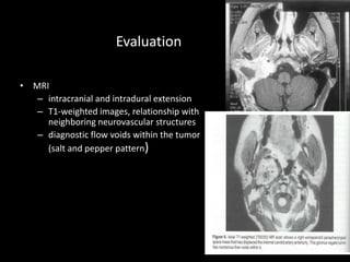 Evaluation
• MRI
– intracranial and intradural extension
– T1-weighted images, relationship with
neighboring neurovascular structures
– diagnostic flow voids within the tumor
(salt and pepper pattern)
 