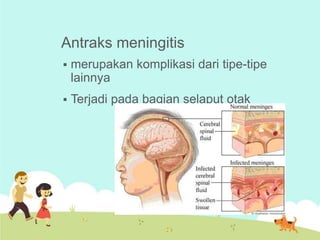 Antraks meningitis


merupakan komplikasi dari tipe-tipe
lainnya



Terjadi pada bagian selaput otak

 