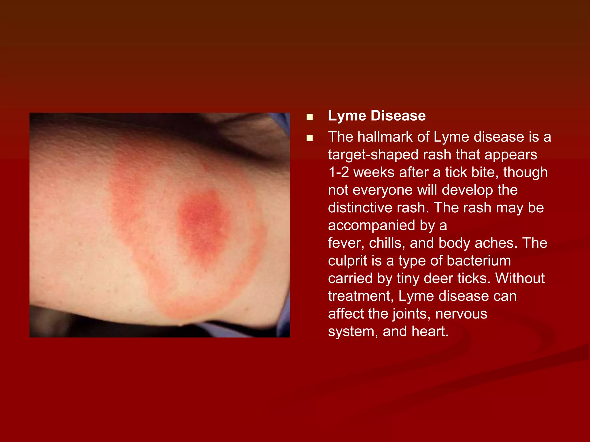 


Lyme Disease
The hallmark of Lyme disease is a
target-shaped rash that appears
1-2 weeks after a tick bite, though
not everyone will develop the
distinctive rash. The rash may be
accompanied by a
fever, chills, and body aches. The
culprit is a type of bacterium
carried by tiny deer ticks. Without
treatment, Lyme disease can
affect the joints, nervous
system, and heart.

 
