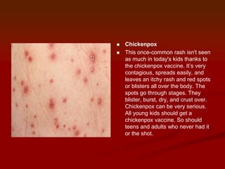 evaluating a child with febrile rash | PPTX