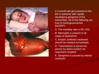 o

o
o

o

o

o

A 4-month-old girl presents to the
ED in extremis with rapidly
developing gangrene of the
extremities. All of the following are
true of meningococcemia
EXCEPT:
A. The mortality rate is 5%-10%
B. Meningitis is present in all
cases of septicemia
C. Empiric antibiotic treatment
should be initiated immediately
D. Transmission is person-toperson by direct contact via
respiratory droplets
E. Gangrene is caused by arterial
occlusion

 