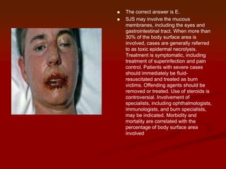 


The correct answer is E.
SJS may involve the mucous
membranes, including the eyes and
gastrointestinal tract. When more than
30% of the body surface area is
involved, cases are generally referred
to as toxic epidermal necrolysis.
Treatment is symptomatic, including
treatment of superinfection and pain
control. Patients with severe cases
should immediately be fluidresuscitated and treated as burn
victims. Offending agents should be
removed or treated. Use of steroids is
controversial. Involvement of
specialists, including ophthalmologists,
immunologists, and burn specialists,
may be indicated. Morbidity and
mortality are correlated with the
percentage of body surface area
involved

 