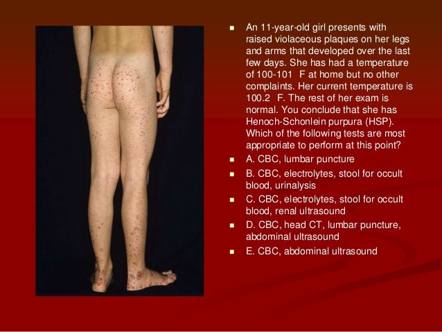 Allopurinol rash pictures 1 year old