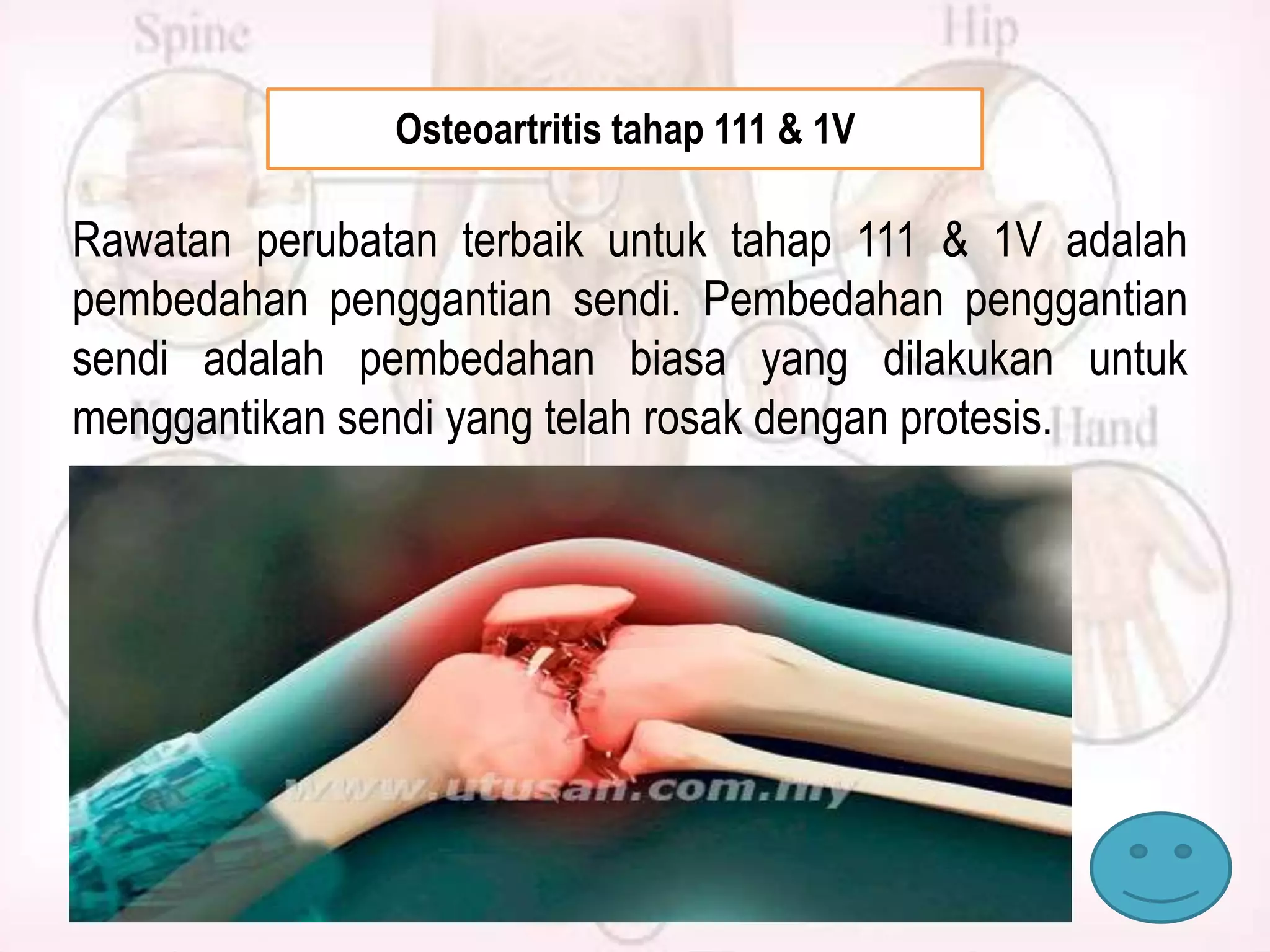Osteoartritis tahap 111 & 1V

Rawatan perubatan terbaik untuk tahap 111 & 1V adalah
pembedahan penggantian sendi. Pembedahan penggantian
sendi adalah pembedahan biasa yang dilakukan untuk
menggantikan sendi yang telah rosak dengan protesis.

 