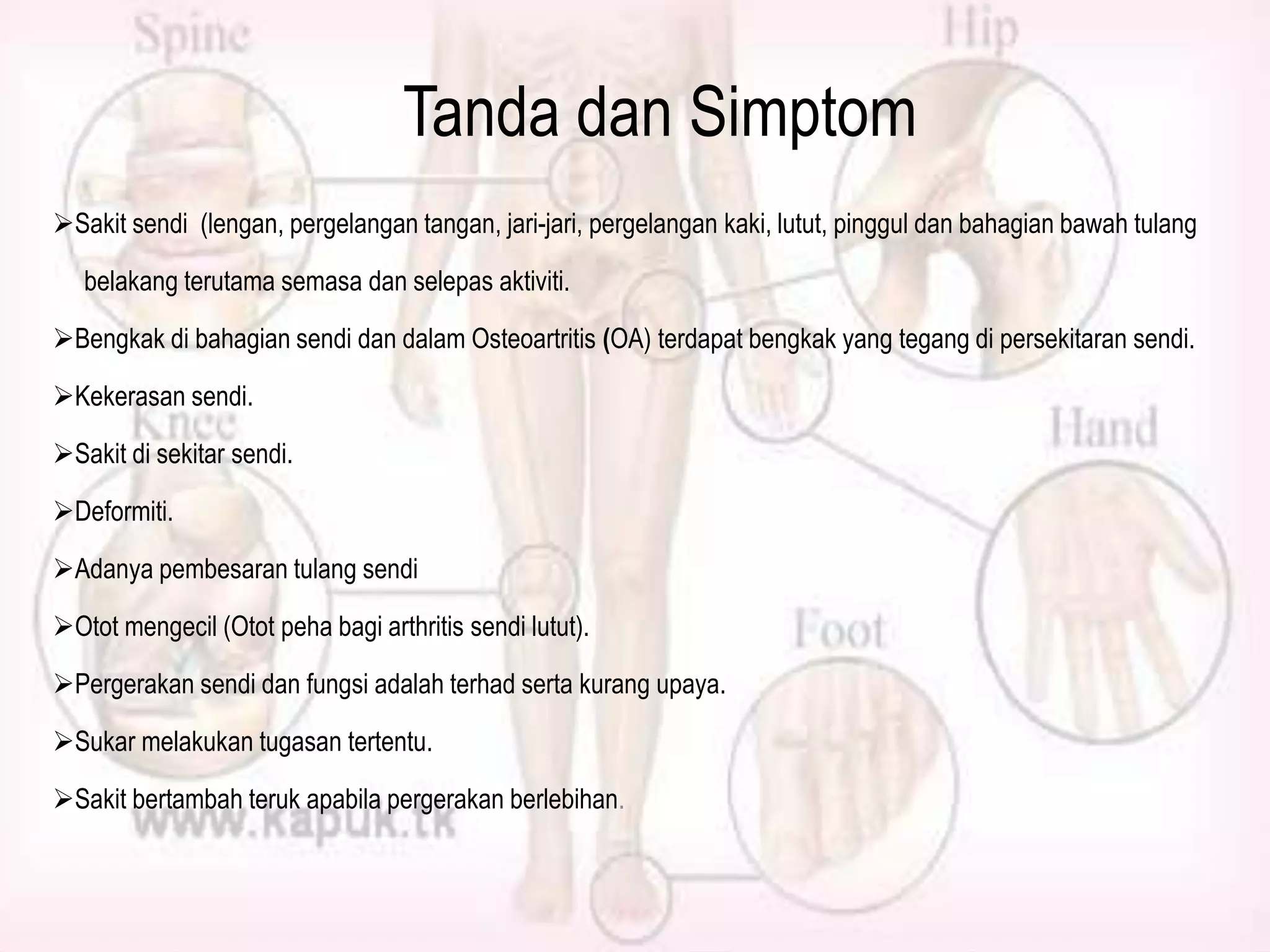 Tanda dan Simptom
Sakit sendi (lengan, pergelangan tangan, jari-jari, pergelangan kaki, lutut, pinggul dan bahagian bawah tulang
belakang terutama semasa dan selepas aktiviti.
Bengkak di bahagian sendi dan dalam Osteoartritis (OA) terdapat bengkak yang tegang di persekitaran sendi.
Kekerasan sendi.
Sakit di sekitar sendi.
Deformiti.
Adanya pembesaran tulang sendi
Otot mengecil (Otot peha bagi arthritis sendi lutut).
Pergerakan sendi dan fungsi adalah terhad serta kurang upaya.

Sukar melakukan tugasan tertentu.
Sakit bertambah teruk apabila pergerakan berlebihan.

 